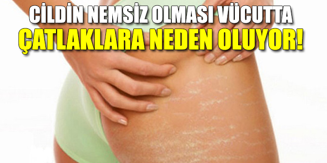 Cildin nemsiz olması vücutta çatlaklara neden oluyor!