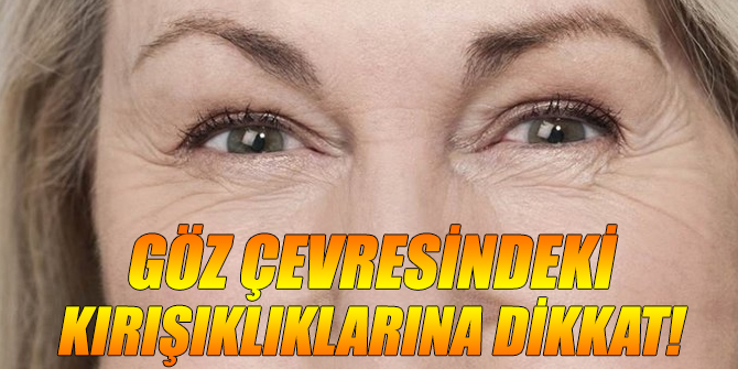 Göz çevresinde oluşan kırışıklıklara dikkat!