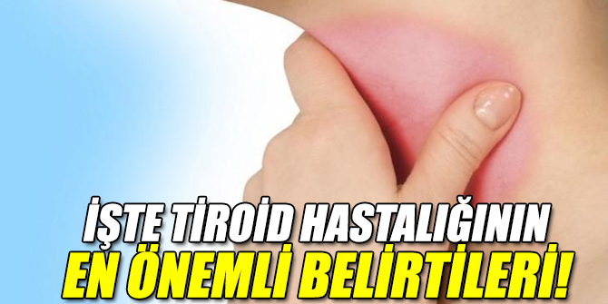 İşte tiroid hastalığının en önemli belirtileri