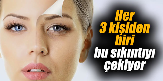 Her 3 kişiden biri bu sıkıntıyı çekiyor