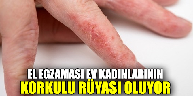 El Egzaması Ev Kadınlarının Korkulu Rüyası Oluyor 7554