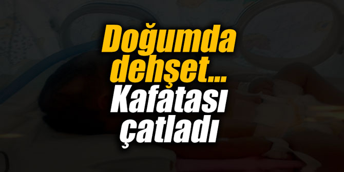 Doğumda dehşet... Kafatası çatladı