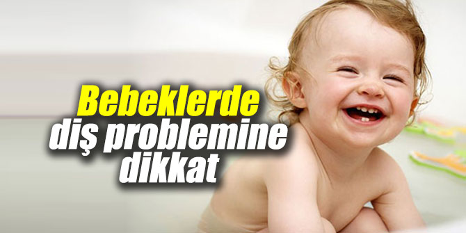 Bebeklerde diş probleminde bunlara dikkat