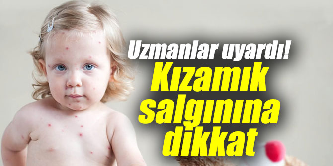 Uzmanlar uyardı! Kızamık salgınına dikkat