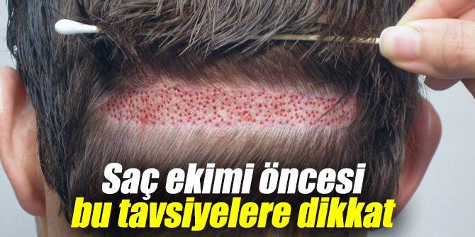 Saç ekimi uzmanından tavsiyeler