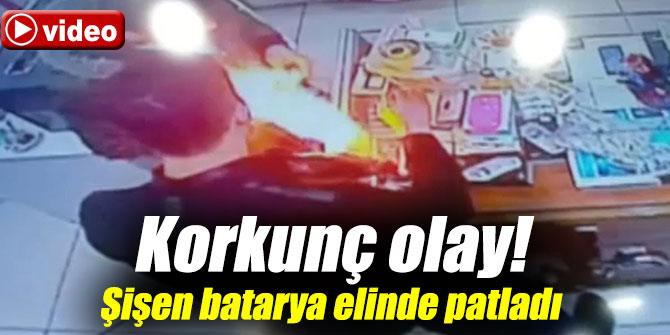 Korkunç olay! Şişen batarya elinde patladı