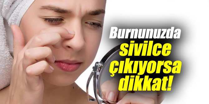 Burnunuzda sivilce çıkıyorsa dikkat!