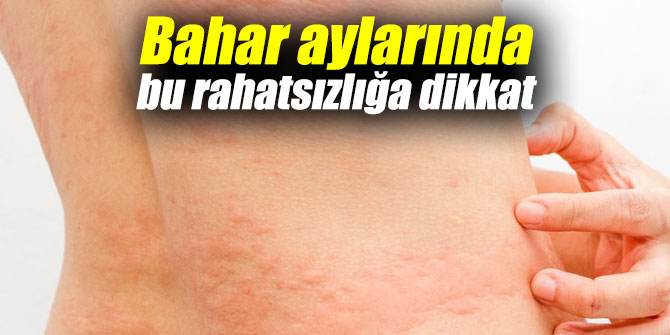 Bahar aylarında bu rahatsızlığa dikkat