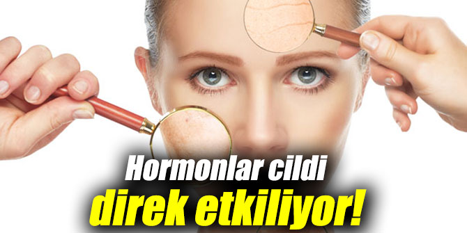 Hormonlar cildi direk etkiliyor!
