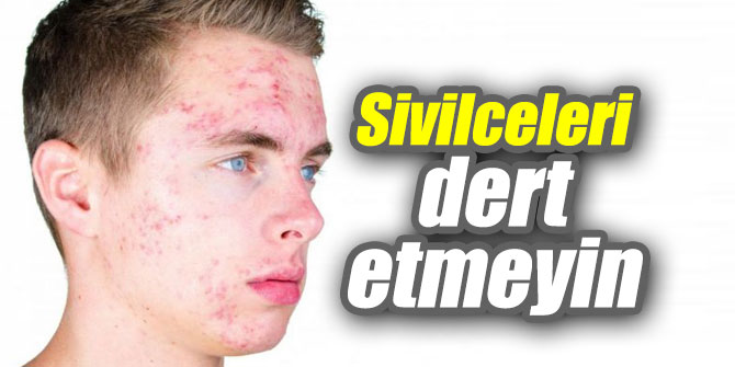 Sivilceler artık dert değil!