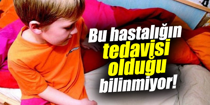 Bu hastalığın tedavisi olduğu bilinmiyor!