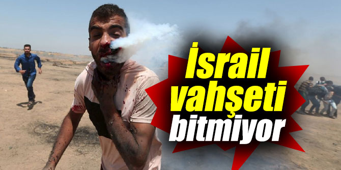 İsrail vahşeti bitmiyor