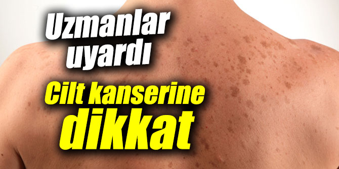 Cilt kanserine dikkat