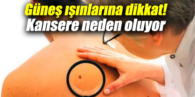 Güneş ışınlarına dikkat! Kansere neden oluyor