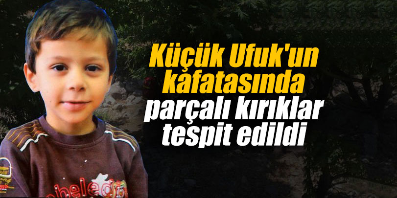 Küçük Ufuk'un kafatasında parçalı kırıklar tespit edildi