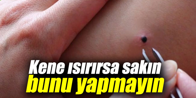 Kene ısırırsa sakın bunu yapmayın