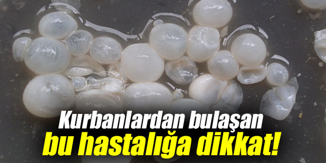 Kurbanlardan bulaşan bu hastalığa dikkat!