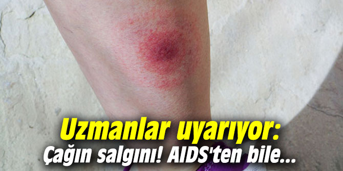 Uzmanlar uyarıyor: Çağın salgını! AIDS'ten bile...