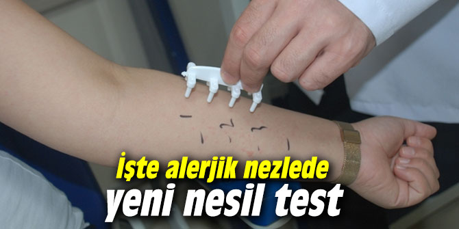 İşte alerjik nezlede yeni nesil test