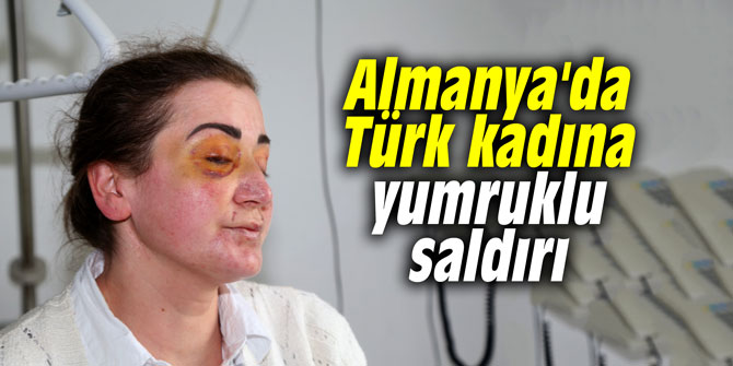 Almanya'da Türk kadına yumruklu saldırı