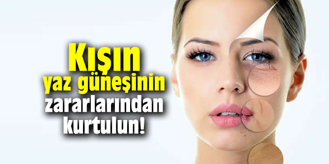 Kışın yaz güneşinin zararlarından kurtulun!