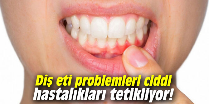 Diş eti problemleri ciddi hastalıkları tetikliyor!