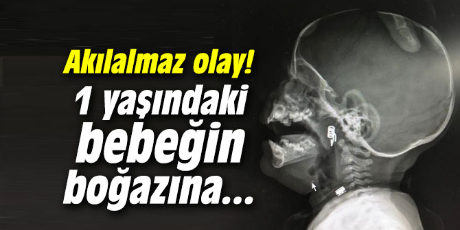 Akılalmaz olay! 1 yaşındaki bebeğin boğazına...