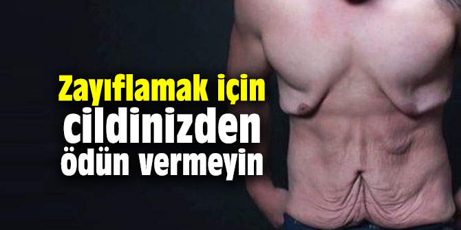 Zayıflamak için cildinizden ödün vermeyin